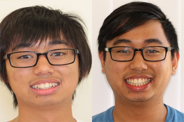 glenview dental treatment